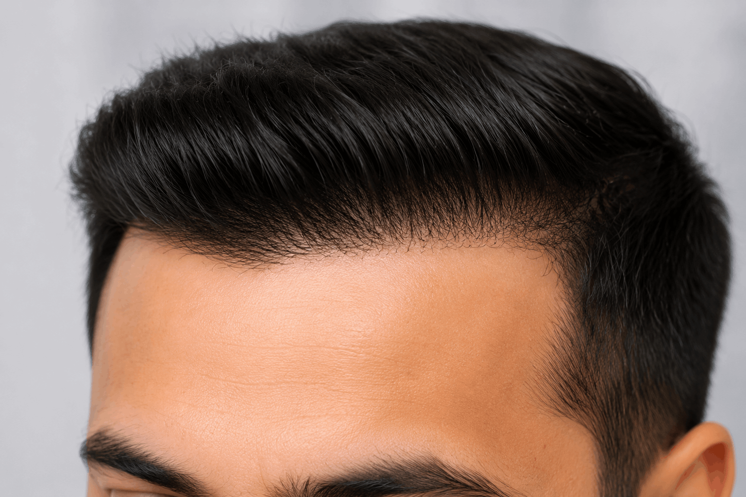 Hair Transplant Nashik